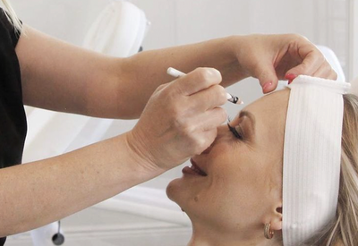 Botox Guide